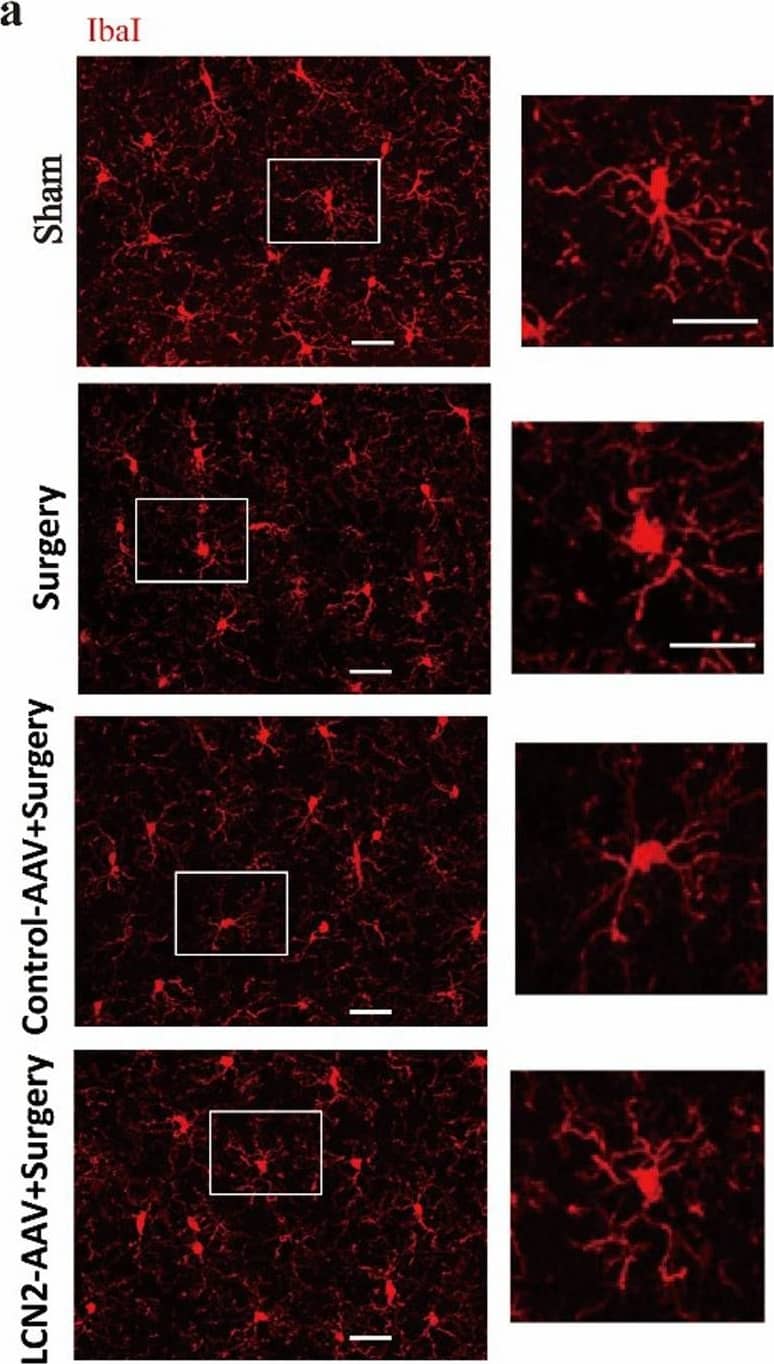Immunocytochemistry/ Immunofluorescence: AIF-1/Iba1 Antibody [NBP2-19019] - Knockdown of LCN2 prevents microglial activation & neuroinflammation. a Representative immunofluorescence images of hippocampal sections with IbaI+ cells (White). Scale bars, 150 µm. b Quantification of the microglia density in (A) (n = 4 mice/group, 2–3 slides/mice). c Quantification of the microglia Ramification index at 24 h after surgery (n = 72 cells from 4 mice/group). d Number of process intersections with shells at distances (in 2 µm in increments) from the soma by Sholl analysis at 24 h after surgery (n = 72 cells from 4 mice/group). e Tissue ELISA of IL-6 at 24 h after surgery (n = 5 mice/group). f Relative expression level of tnf-alpha , IL-6 and/or IL-1 beta  6 h after application of rLCN2 (500 ng/mL) on BV-2 (n = 4–6/group) & primary microglia cells (n = 3/group). Vehicle: PBS buffer. Data represent mean ± SEM; n = 4/group. * P < 0.05; *** P < 0.001 Image collected & cropped by CiteAb from the following publication (//pubmed.ncbi.nlm.nih.gov/35413913), licensed under a CC-BY license. Not internally tested by Novus Biologicals.
