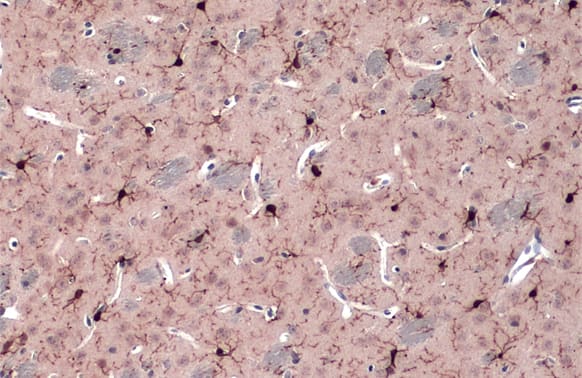 Immunohistochemistry-Paraffin: AIF-1/Iba1 Antibody [NBP2-19019] - AIF-1/Iba1 antibody detects AIF-1/Iba1 protein at cell membrane and cytoplasm by immunohistochemical analysis.Sample: Paraffin-embedded mouse brain.AIF-1/Iba1 stained by AIF-1/Iba1 antibody (NBP2-19019) diluted at 1:500.Antigen Retrieval: Citrate buffer, pH 6.0, 15 min