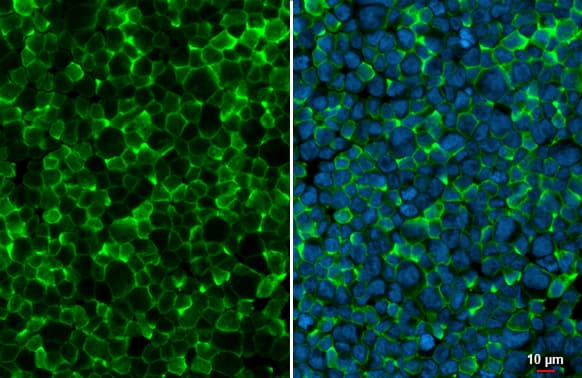 Immunocytochemistry/ Immunofluorescence: AIF-1/Iba1 Antibody [NBP2-19019] - AIF-1/Iba1 antibody detects AIF-1/Iba1 protein at cell membrane by immunofluorescent analysis.Sample: THP-1 cells were fixed in 4% paraformaldehyde at RT for 15 min.Green: AIF-1/Iba1 stained by AIF-1/Iba1 antibody (NBP2-19019) diluted at 1:500.Blue: Fluoroshield with DAPI .