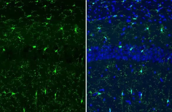 Immunocytochemistry/ Immunofluorescence: AIF-1/Iba1 Antibody [NBP2-19019] - LCN2 mainly expressed on neurons. a Representative immunofluorescence images of LCN2 (green), GFAP (red), NeuN (red) & IbaI (red) staining in sections of the hippocampus after surgery. Long scale bar, 600 µm; short scale bar, 25 µm. b Percentage quantification of LCN2 positive cells (n = 3 mice/group). c Cartoon depicting MACS sorting procedures for isolating CD11b+ & CD11b − cells. d Relative expression of cx3cr1 in CD11b + & CD11b − cells after sorting from all samples. d Relative expression level of Lcn2 mRNA in CD11b + & CD11b − cells from hippocampus 6 h after surgery. e Relative expression level of IL-6 mRNA in CD11b + cells. Data are represented as mean ± SEM. **** P Sample: Frozen-sectioned mouse brain.Green: AIF-1/Iba1 stained by AIF-1/Iba1 antibody (NBP2-19019) diluted at 1:500.Blue: Fluoroshield with DAPI .Antigen Retrieval: ice-cold MeOH for 5 min