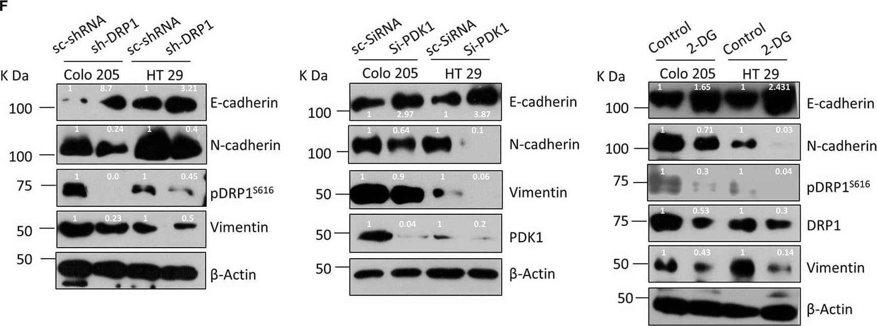 Mitochondrial fission regulates migration & invasion in BRAFV600E CRC cells through glucose metabolic reprograming. (A) Relative cell invasion post vemurafenib treatment in BRAFV600E cells (n=3, mean ± SEM); statistical analysis was done by unpaired t-test followed by Welch’s correction assuming unequal variance in means, corresponding p values shown. (B) Western blot showing a reduction in EMT markers upon vemurafenib treatment in BRAFV600E cells. Relative cellular invasion post (C) DRP1 silencing, (D) PDK1 silencing, & (E) 2-deoxyglucose treatment in Colo205 & HT29 cells (n=3, mean± SEM); statistical analysis was done by unpaired t-test followed by Welch’s correction assuming unequal variance in means, corresponding p values shown. (F) Western blots showing a reduction in epithelial mesenchymal transition (EMT) markers upon DRP1 silencing, PDK1 knockdown, & 2-DG treatment in Colo205 & HT29 cells. Image collected & cropped by CiteAb from the following publication (//pubmed.ncbi.nlm.nih.gov/33738242), licensed under a CC-BY license. Not internally tested by Novus Biologicals.