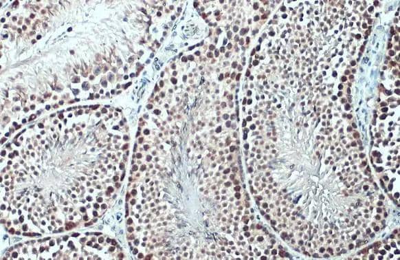 TET1 antibody [N1], N-term detects TET1 protein at nucleus by immunohistochemical analysis.Sample: Paraffin-embedded mouse testis.TET1 stained by TET1 antibody [N1], N-term (NBP2-19290) diluted at 1:500.Antigen Retrieval: Citrate buffer, pH 6.0, 15 min 