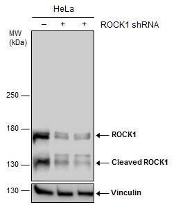 <b>Genetic Strategies Validation. </b>Non-transfected (-) and transfected (+) HeLa whole cell extracts (30 ug) were separated by 5% SDS-PAGE, and the membrane was blotted with ROCK1 antibody (NBP2-19297) diluted at 1:500. 