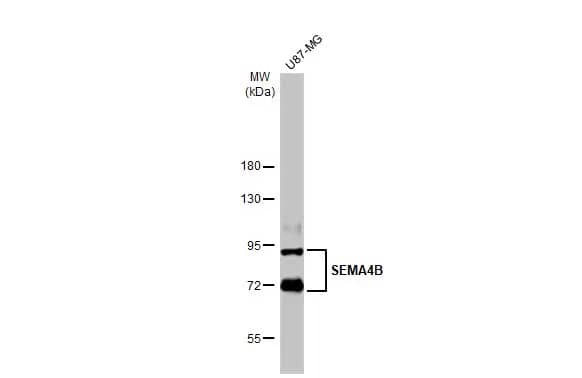 Western Blot: Semaphorin 4B Antibody [NBP2-19299] - Whole cell extract (30 ug) was separated by 7.5% SDS-PAGE, and the membrane was blotted with Semaphorin 4B antibody (NBP2-19299) diluted at 1:1000. The HRP-conjugated anti-rabbit IgG antibody  was used to detect the primary antibody.