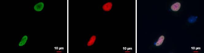 RFP antibody detects RFP protein at by immunofluorescent analysis.Sample: RFP tagged protein transfected HeLa cells were fixed in 4% paraformaldehyde at RT for 15 min.Green: RFP protein stained by RFP antibody (NBP2-19302) diluted at 1:5000.Red: RFP is expressed in the RFP-fusion protein tranfected cell.Blue: Hoechst 33342 staining.The cell of merger panel with no RFP expressed as a negative control. 