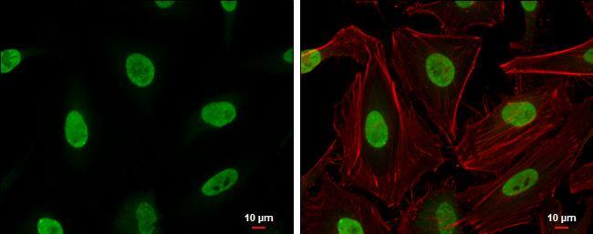 Ku70 antibody detects Ku70 protein at nucleus by immunofluorescent analysis. Samples: HeLa cells were fixed in 4% paraformaldehyde at RT for 15 min.Green: Ku70 protein stained by Ku70 antibody (NBP2-19311) diluted at 1:200.Red: phalloidin, a cytoskeleton marker, diluted at 1:200.Scale bar = 10 um. 