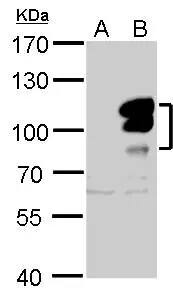 Western Blot: L3MBTL1 Antibody [NBP2-19317] - L3MBTL antibody detects L3MBTL protein by Western blot analysis.A. 30 ug 293T whole cell lysate/extractB. 30 ug whole cell lysate/extract of human L3MBTL-transfected 293T cells7.5 % SDS-PAGEL3MBTL antibody (NBP2-19317) dilution: 1:5000