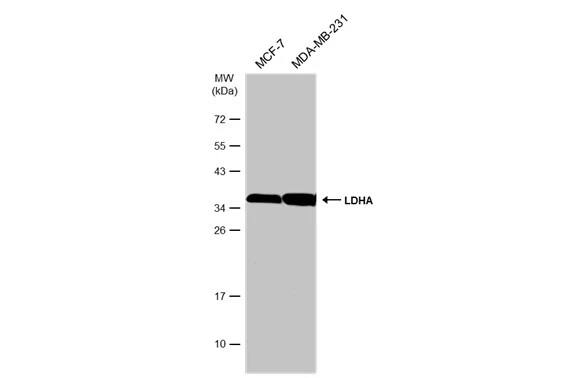 Western Blot: Lactate Dehydrogenase A/LDHA Antibody [NBP2-19320] - Various whole cell extracts (30 ug) were separated by 12% SDS-PAGE, and the membrane was blotted with Lactate Dehydrogenase A/LDHA antibody (NBP2-19320) diluted at 1:1000. The HRP-conjugated anti-rabbit IgG antibody  was used to detect the primary antibody.