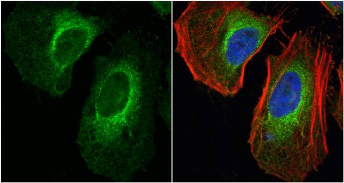 LDHA antibody detects LDHA protein at cytoplasm by immunofluorescent analysis.Sample: HeLa cells were fixed in 4% paraformaldehyde at RT for 15 min.Green: LDHA protein stained by LDHA antibody (NBP2-19320) diluted at 1:1000.Red: phalloidin, a cytoskeleton marker, stained by phalloidin (invitrogen, A12380) diluted at 1:200.Blue: Hoechst 33342 staining. 
