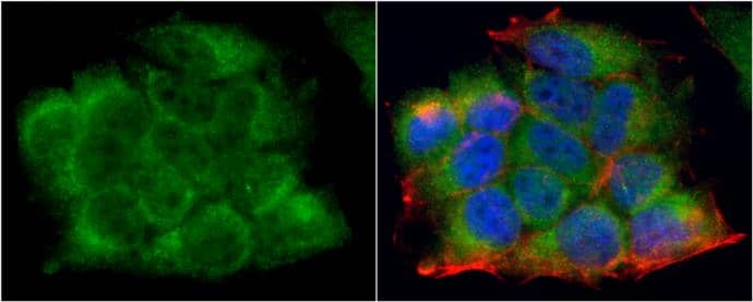 LDHA antibody detects LDHA protein at cytoplasm by immunofluorescent analysis.Sample: MCF7 cells were fixed in 4% paraformaldehyde at RT for 15 min.Green: LDHA protein stained by LDHA antibody (NBP2-19320) diluted at 1:1000.Red: phalloidin, a cytoskeleton marker, stained by phalloidin (invitrogen, A12380) diluted at 1:200.Blue: Hoechst 33342 staining. 