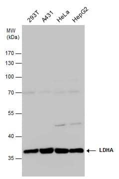LDHA antibody detects LDHA protein by western blot analysis. Various whole cell extracts (30 ug) were separated by 10% SDS-PAGE, and the membrane was blotted with LDHA antibody (NBP2-19320) diluted at 1:1000. The HRP-conjugated anti-rabbit IgG antibody  was used to detect the primary antibody. 
