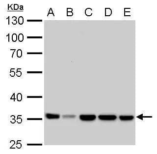 LDHA antibody detects LDHA protein by western blot analysis.A. 30 ug Neuro2A whole cell lysate/extract B. 30 ug C8D30 whole cell lysate/extract C. 30 ug NIH-3T3 whole cell lysate/extract D. 30 ug Raw264.7 whole cell lysate/extract E. 30 ug C2C12 whole cell lysate/extract10% SDS-PAGELDHA antibody (NBP2-19320) dilution: 1:1000 The HRP-conjugated anti-rabbit IgG antibody  was used to detect the primary antibody. 