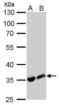 LDHA antibody detects LDHA protein by western blot analysis.A. 30 ug PC-12 whole cell lysate/extractB. 30 ug Rat2 whole cell lysate/extract10% SDS-PAGELDHA antibody (NBP2-19320) dilution: 1:1000 The HRP-conjugated anti-rabbit IgG antibody  was used to detect the primary antibody. 