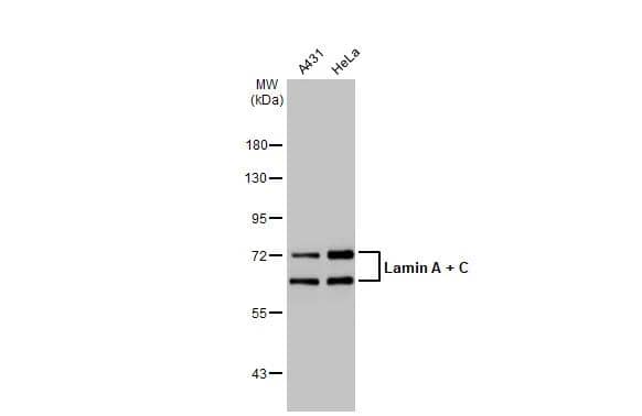 Various whole cell extracts (30 ug) were separated by 7.5% SDS-PAGE, and the membrane was blotted with Lamin A + C antibody (NBP2-19324) diluted at 1:5000. The HRP-conjugated anti-rabbit IgG antibody  was used to detect the primary antibody. 