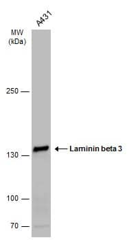 Western Blot: Laminin beta 3 Antibody [NBP2-19326] - Whole cell extract (30 ug) was separated by 5% SDS-PAGE, and the membrane was blotted with Laminin beta 3 antibody [C1C3] (NBP2-19326) diluted at 1:500. The HRP-conjugated anti-rabbit IgG antibody  was used to detect the primary antibody.