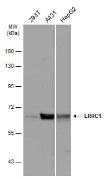 Various whole cell extracts (30 ug) were separated by 7.5% SDS-PAGE, and the membrane was blotted with LRRC1 antibody [C1C3] (NBP2-19332) diluted at 1:2000. The HRP-conjugated anti-rabbit IgG antibody  was used to detect the primary antibody. 