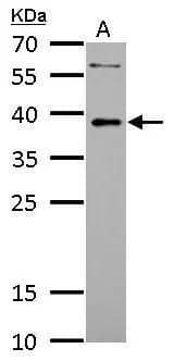 LDB3 antibody detects LDB3 protein by western blot analysis.A. 30 ug RD whole cell lysate/extract12% SDS-PAGELDB3 antibody (NBP2-19343) dilution: 1:1000 The HRP-conjugated anti-rabbit IgG antibody  was used to detect the primary antibody. 