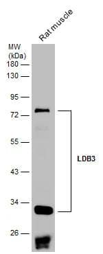 Rat tissue extract (50 ug) was separated by 10% SDS-PAGE, and the membrane was blotted with LDB3 antibody (NBP2-19343) diluted at 1:1000. The HRP-conjugated anti-rabbit IgG antibody  was used to detect the primary antibody. 