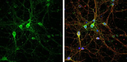 LINGO1 antibody [C1C3] detects LINGO1 protein by immunofluorescent analysis.Sample: DIV9 rat E18 primary cortical neuron cells were fixed in 4% paraformaldehyde at RT for 15 min.Green: LINGO1 stained by LINGO1 antibody [C1C3] (NBP2-19359) diluted at 1:500.Red: beta Tubulin 3/ Tuj1, stained by beta Tubulin 3/ Tuj1 antibody [GT1338]  diluted at 1:500.Blue: Fluoroshield with DAPI . 