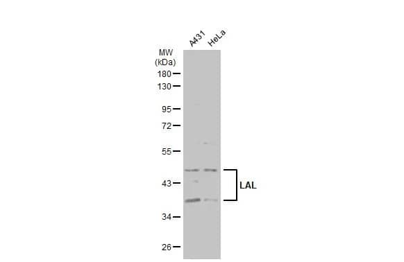 Western Blot: Lipase A Antibody [NBP2-19360] - Various whole cell extracts (30 ug) were separated by 10% SDS-PAGE, and the membrane was blotted with Lipase A antibody [N3C3] (NBP2-19360) diluted at 1:1000. The HRP-conjugated anti-rabbit IgG antibody  was used to detect the primary antibody.