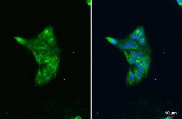 LAL antibody [N3C3] detects LAL protein at lysosome by immunofluorescent analysis.Sample: HepG2 cells were fixed in ice-cold MeOH for 5 min.Green: LAL stained by LAL antibody [N3C3] (NBP2-19360) diluted at 1:500.Blue: Fluoroshield with DAPI . 