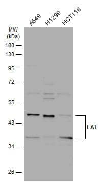 Various whole cell extracts (30 ug) were separated by 10% SDS-PAGE, and the membrane was blotted with LAL antibody [N3C3] (NBP2-19360) diluted at 1:1000. The HRP-conjugated anti-rabbit IgG antibody  was used to detect the primary antibody. 