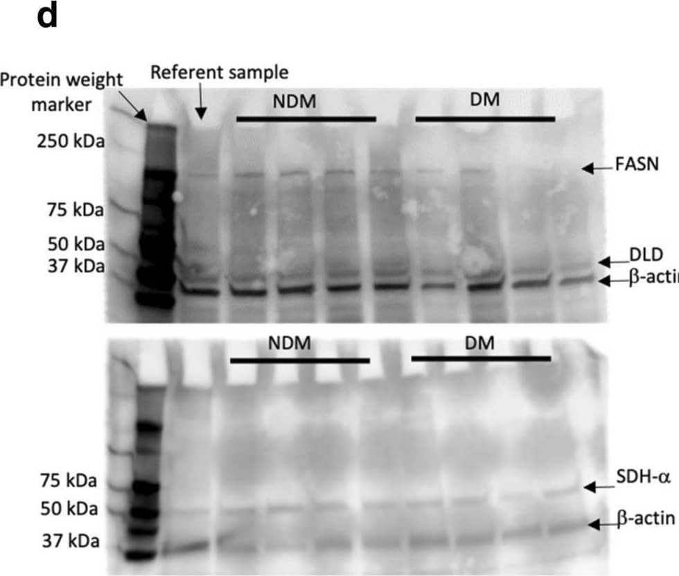 Sample preparation and differentially abundant proteins in DM and NDM tissues. Sample preparation was reproducible and similar between groups, as determined by the number of proteins quantified (a) and principal component analysis (b); no significant difference between groups was observed in number of proteins quantified; principal component projection does not separate DM from NDM samples indicating that overall protein composition of samples is similar between groups. (c) Volcano plots of protein abundance in DM compared with NDM samples. Light grey dots indicate differentially abundant proteins between groups; black dots represent proteins that were not significantly regulated. Labels indicate gene symbols. (d) Western blots for select targets differentially regulated in proteomic analysis. (e) Western blotting densitometry quantification. *p-value < 0.001, independent t-test comparing NDM (n = 8) to DM (n = 8) densitometry values, normalized to actin as described in methods. Image collected and cropped by CiteAb from the following open publication (//pubmed.ncbi.nlm.nih.gov/34462518), licensed under a CC-BY license. Not internally tested by Novus Biologicals.