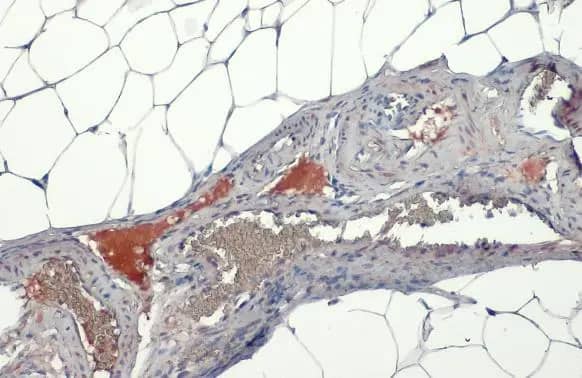 Immunohistochemistry-Paraffin: Lipoprotein Lipase/LPL Antibody [NBP2-19364] - Lipoprotein Lipase/LPL antibody [N2C2], Internal detects secreted Lipoprotein Lipase/LPL protein by immunohistochemical analysis.Sample: Paraffin-embedded mouse white adipocyte.Lipoprotein Lipase/LPL stained by Lipoprotein Lipase/LPL antibody [N2C2], Internal (NBP2-19364) diluted at 1:500.Antigen Retrieval: Citrate buffer, pH 6.0, 15 min