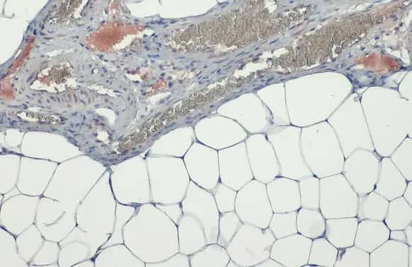 Immunohistochemistry-Paraffin: Lipoprotein Lipase/LPL Antibody [NBP2-19364] - Lipoprotein Lipase/LPL antibody [N2C2], Internal detects secreted Lipoprotein Lipase/LPL protein by immunohistochemical analysis.Sample: Paraffin-embedded mouse white adipocyte.Lipoprotein Lipase/LPL stained by Lipoprotein Lipase/LPL antibody [N2C2], Internal (NBP2-19364) diluted at 1:500.Antigen Retrieval: Citrate buffer, pH 6.0, 15 min