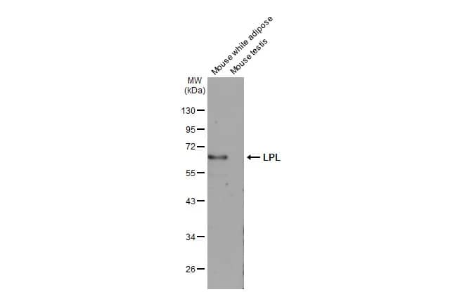 Western Blot: Lipoprotein Lipase/LPL Antibody [NBP2-19364] - Various tissue extracts (50 ug) were separated by 10% SDS-PAGE, and the membrane was blotted with Lipoprotein Lipase/LPL antibody [N2C2], Internal (NBP2-19364) diluted at 1:1000. The HRP-conjugated anti-rabbit IgG antibody  was used to detect the primary antibody.