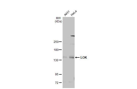 Various whole cell extracts (30 ug) were separated by 5% SDS-PAGE, and the membrane was blotted with LOK antibody [N1N2], N-term (NBP2-19368) diluted at 1:2000. The HRP-conjugated anti-rabbit IgG antibody  was used to detect the primary antibody, and the signal was developed with Trident ECL plus-Enhanced. 