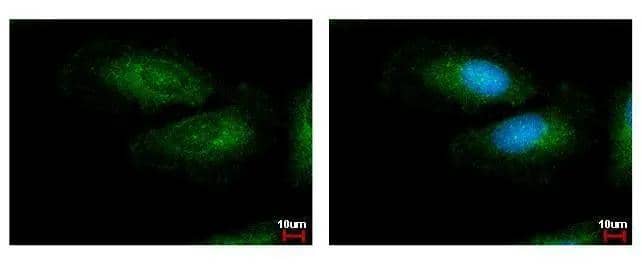 LRG1 antibody detects LRG1 protein at cytoplasm by immunofluorescent analysis. Sample: HeLa cells were fixed in ice-cold MeOH for 5 min.Green: LRG1 protein stained by LRG1 antibody (NBP2-19372) diluted at 1:500.Blue: Hoechst 33342 staining. 
