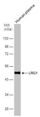 Human tissue extract (30 ug) was separated by 10% SDS-PAGE, and the membrane was blotted with LRG1 antibody (NBP2-19372) diluted at 1:1000. 