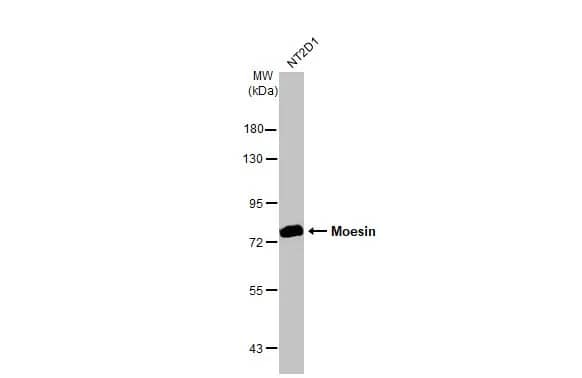 Western Blot: Moesin Antibody [NBP2-19376] - Whole cell extract (30 ug) was separated by 7.5% SDS-PAGE, and the membrane was blotted with Moesin antibody [C2C3], C-term (NBP2-19376) diluted at 1:1000. The HRP-conjugated anti-rabbit IgG antibody  was used to detect the primary antibody.