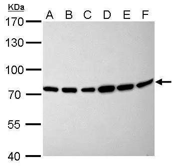 Moesin antibody [C2C3], C-term detects MSN protein by Western blot analysis.A. 30 ug GL261 whole cell lysate/extract B. 30 ug C8D30 whole cell lysate/extract C. 30 ug NIH-3T3 whole cell lysate/extract D. 30 ug BCL-1 whole cell lysate/extract E. 30 ug Raw264.7 whole cell lysate/extract F. 30 ug C2C12 whole cell lysate/extract 7.5 % SDS-PAGEMoesin antibody [C2C3], C-term (NBP2-19376) dilution: 1:1000 