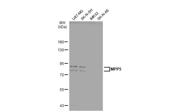 Various whole cell extracts (30 ug) were separated by 7.5% SDS-PAGE, and the membrane was blotted with MPP5 antibody [N1N2], N-term (NBP2-19389) diluted at 1:1000. The HRP-conjugated anti-rabbit IgG antibody  was used to detect the primary antibody. 