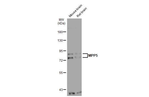 Various tissue extracts (30 ug) were separated by 7.5% SDS-PAGE, and the membrane was blotted with MPP5 antibody [N1N2], N-term (NBP2-19389) diluted at 1:1000. The HRP-conjugated anti-rabbit IgG antibody  was used to detect the primary antibody. 