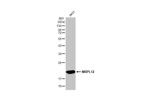 Western Blot: MRPL12 Antibody [NBP2-19397] - Whole cell extract (30 ug) was separated by 12% SDS-PAGE, and the membrane was blotted with MRPL12 antibody [N1C3] (NBP2-19397) diluted at 1:1000. The HRP-conjugated anti-rabbit IgG antibody  was used to detect the primary antibody.