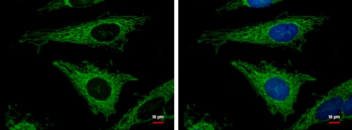 Immunocytochemistry/ Immunofluorescence: MRPL12 Antibody [NBP2-19397] - MRPL12 antibody [N1C3] detects MRPL12 protein at mitochondria by immunofluorescent analysis.Sample: HeLa cells were fixed in 2% paraformaldehyde/culture medium at 37ºC for 30 min.Green: MRPL12 protein stained by MRPL12 antibody [N1C3] (NBP2-19397) diluted at 1:500.Blue: Hoechst 33342 staining.