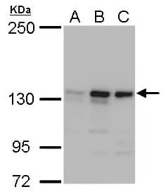 Western Blot: MSH3 Antibody [NBP2-19418] - MSH3 antibody detects MSH3 protein by Western blot analysis.A. 30 ug A549 whole cell lysate/extractB. 30 ug H1299 whole cell lysate/extractC. 30 ug HCT116 whole cell lysate/extract5 % SDS-PAGEMSH3 antibody (NBP2-19418) dilution: 1:1000