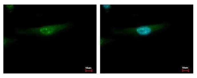 YBX2 antibody [N2C2], Internal detects YBX2 protein at cytoplasm and nucleus by immunofluorescent analysis. Sample: HeLa cells were fixed in ice-cold MeOH for 5 min.Green: YBX2 protein stained by YBX2 antibody [N2C2], Internal (NBP2-19422) diluted at 1:500.Blue: Hoechst 33343 staining. 