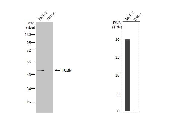 Western Blot MTAC2D1 Antibody