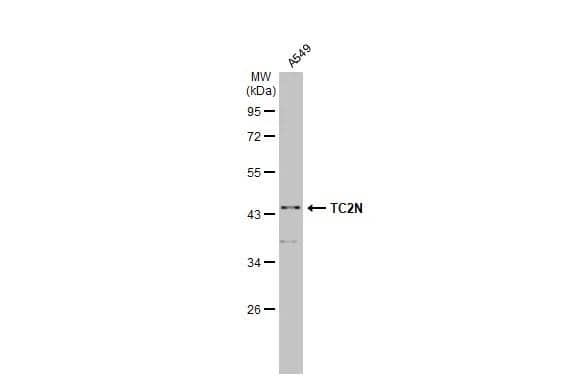 Western Blot MTAC2D1 Antibody