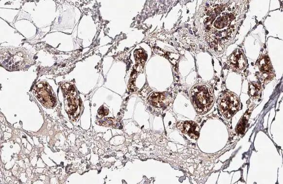 Immunohistochemistry-Paraffin mtTFA Antibody - BSA Free