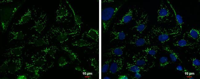 Immunocytochemistry/ Immunofluorescence mtTFA Antibody