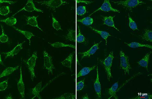 Immunocytochemistry/ Immunofluorescence mtTFA Antibody