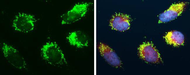 Immunocytochemistry/ Immunofluorescence mtTFA Antibody