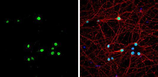 Muscleblind-like 1 antibody detects Muscleblind-like 1 protein by immunofluorescent analysis.Sample: DIV9 rat E18 primary hippocampal neuron cells were fixed in 4% paraformaldehyde at RT for 15 min.Green: Muscleblind-like 1 stained by Muscleblind-like 1 antibody (NBP2-19445) diluted at 1:500.Red: beta Tubulin 3/ Tuj1, stained by beta Tubulin 3/ Tuj1 antibody [GT11710]  diluted at 1:500.Blue: Fluoroshield with DAPI . 