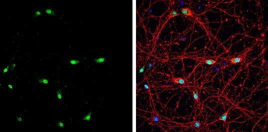 Muscleblind-like 1 antibody [N1C2] detects Muscleblind-like 1 protein by immunofluorescent analysis.Sample: DIV9 rat E18 primary hippocampal neuron cells were fixed in 4% paraformaldehyde at RT for 15 min.Green: Muscleblind-like 1 stained by Muscleblind-like 1 antibody [N1C2] (NBP2-19446) diluted at 1:500.Red: beta Tubulin 3/ Tuj1, stained by beta Tubulin 3/ Tuj1 antibody [GT11710]  diluted at 1:500.Blue: Fluoroshield with DAPI . 