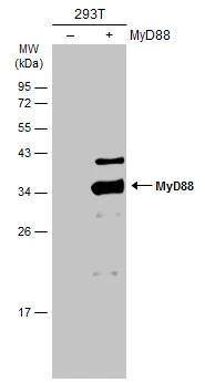 Non-transfected (-) and transfected (+) 293T whole cell extracts (30 ug) were separated by 12% SDS-PAGE, and the membrane was blotted with MyD88 antibody (NBP2-19448) diluted at 1:5000. The HRP-conjugated anti-rabbit IgG antibody  was used to detect the primary antibody. 